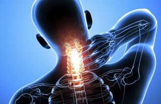 Osteocondrosi cervicale