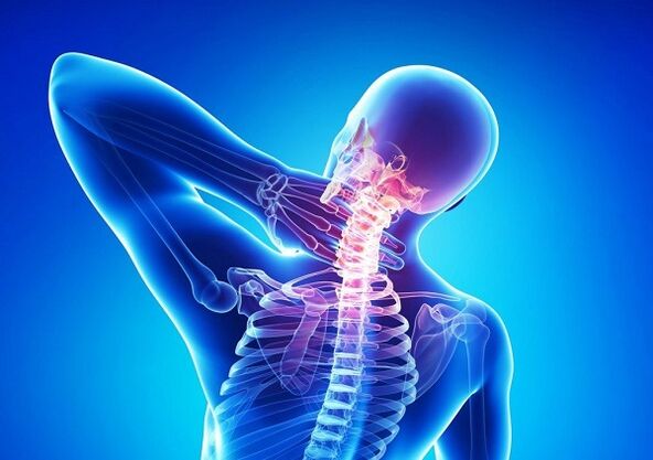 dolore al rachide cervicale con osteocondrosi