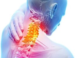 I principali segni e sintomi dell'osteocondosi cervicale