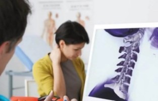 Il trattamento di artrosi cervicale